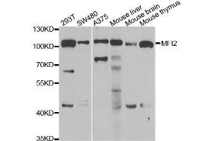 Western blot analysis of extracts of various cell lines, using MFI2 antibody. (MFI2 抗体  (AA 20-200))