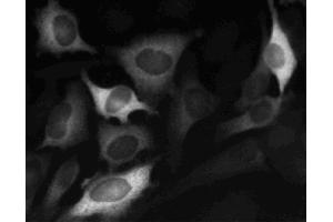 Immunofluorescent staining of HeLa (ATCC CCL-2) cells. (Cyclin B1 抗体)