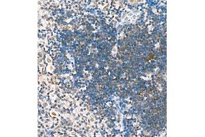 Immunohistochemistry of paraffin embedded mouse thymus using Skar (ABIN7074970) at dilution of 1:1800 (400x lens) (p46 抗体)