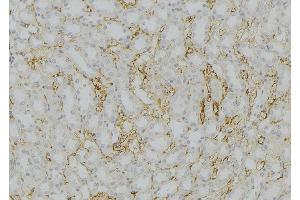 ABIN6272567 at 1/100 staining Mouse kidney tissue by IHC-P. (CYP11B2 抗体  (Internal Region))