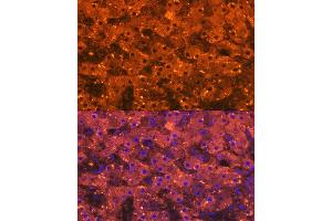 Immunofluorescence analysis of human liver using Alpha-2-Macroglobulin (Alpha-2-Macroglobulin (M)) Rabbit mAb (ABIN7265558) at dilution of 1:100 (40x lens). (alpha 2 Macroglobulin 抗体)