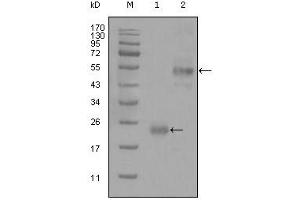 Western blot analysis using CD44 mouse mAb against truncated Trx-CD44 recombinant protein (1) and GST-CD44 (aa628-699) recombinant protein (2). (CD44 抗体)