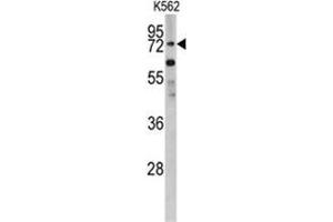 Western blot analysis of PLZF antibody (C-term) in K562 cell line lysates (35ug/lane). (ZBTB16 抗体  (C-Term))