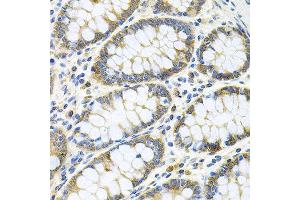 Immunohistochemistry of paraffin-embedded human colon using GNE antibody at dilution of 1:100 (x40 lens). (GNE 抗体)