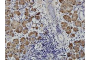 Image no. 1 for anti-Homeodomain Interacting Protein Kinase 1 (HIPK1) (AA 330-430) antibody (ABIN466275) (HIPK1 抗体  (AA 330-430))