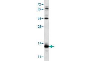 Western blot analysis of NCI-H460 cell lysate (35 ug/lane) with RCAN2 polyclonal antibody . (RCAN2 抗体  (N-Term))