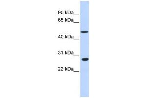 Western Blotting (WB) image for anti-Zinc Finger Protein 556 (ZNF556) antibody (ABIN2458203) (ZNF556 抗体)