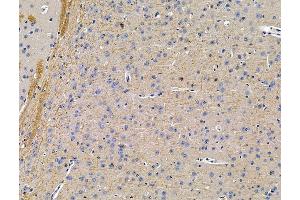 ABIN7096223 and ABIN7100285 at 1/100 staining mouse brain tissue by IHC-P.