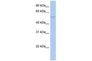 ALG1 antibody used at 1 ug/ml to detect target protein. (ALG1 抗体  (N-Term))