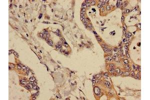 Immunohistochemistry (IHC) image for anti-Glucosaminyl (N-Acetyl) Transferase 3, Mucin Type (GCNT3) (AA 250-419) antibody (ABIN7145363)