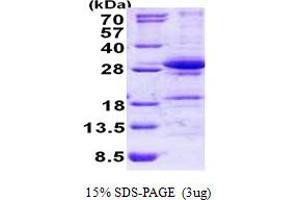 SDS-PAGE (SDS) image for DiGeorge Syndrome Critical Region Gene 6-Like (DGCR6L) (AA 1-220) protein (His tag) (ABIN6387183) (DGCR6L Protein (AA 1-220) (His tag))