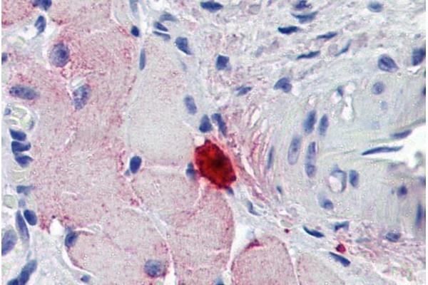 Myonase 抗体  (Internal Region)