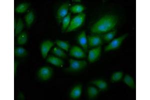 Immunofluorescence staining of A549 cells with ABIN7151176 at 1:266, counter-stained with DAPI. (RNF213 抗体  (AA 202-350))