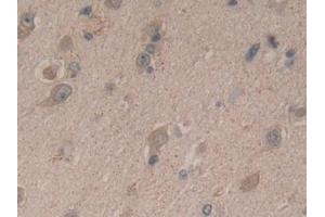 Immunohistochemistry (IHC) image for anti-Stromal Cell Derived Factor 2 (SDF2) (AA 19-211) antibody (ABIN7439993)