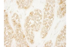 Immunohistochemistry (IHC) image for anti-rho Guanine Nucleotide Exchange Factor (GEF) 16 (ARHGEF16) (AA 175-225) antibody (ABIN7448415)