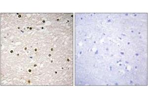 Immunohistochemistry analysis of paraffin-embedded human brain tissue, using p73 Antibody.