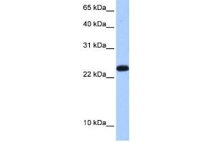 WB Suggested Anti-C19orf24 Antibody Titration:  0. (C19orf24 抗体  (N-Term))