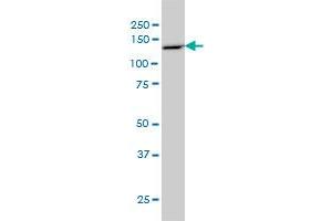 PCDH8 monoclonal antibody (M01), clone 6A8 Western Blot analysis of PCDH8 expression in COLO 320 HSR . (Protocadherin 8 抗体  (AA 32-120))