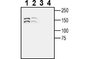anti-Seizure Related 6 Homolog (SEZ6) (AA 849-863), (Extracellular) antibody
