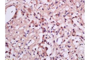 Formalin-fixed and paraffin embedded rat brain tissue labeled with Anti-MSRB2 Polyclonal Antibody, Unconjugated  at 1:300 followed by conjugation to the secondary antibody and DAB staining (MSRB2 抗体  (AA 31-130))