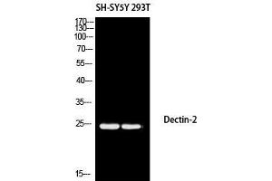 Western Blot (WB) analysis of SH-SY5Y 293T using Dectin-2 antibody.