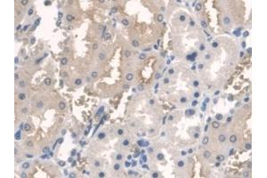 Detection of ARNTL in Rat Kidney Tissue using Polyclonal Antibody to Aryl Hydrocarbon Receptor Nuclear Translocator Like Protein (ARNTL) (ARNTL 抗体  (AA 1-169))