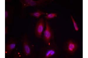 Immunofluorescence staining of methanol-fixed HeLa cells using ATF-2 (phospho-Thr69 or 51) antibody (E011030, Red) (ATF2 抗体  (pThr51, pThr69))
