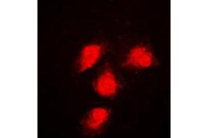 Immunofluorescent analysis of ERK1/2 staining in NIH3T3 cells. (ERK1/2 抗体  (Center))