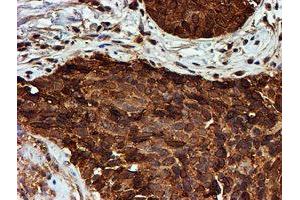 Image no. 14 for anti-Proteasome (Prosome, Macropain) Subunit, beta Type, 9 (Large Multifunctional Peptidase 2) (PSMB9) (AA 21-219) antibody (ABIN1491194)