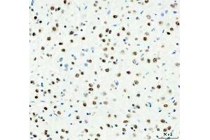 IHC analysis of DDX1 using anti-DDX1 antibody (ABIN7602052). (DDX1 抗体  (AA 562-740))