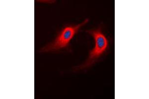 Immunofluorescent analysis of ABHD12B staining in K562 cells. (ABHD12B 抗体  (C-Term))