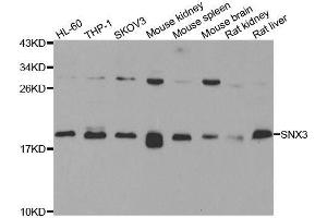 Western blot analysis of extracts of various cell lines, using SNX3 antibody. (Sorting Nexin 3 抗体  (AA 1-162))