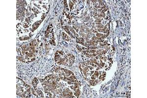 IHC analysis of FADS1 using anti-FADS1 antibody (ABIN7599175). (FADS1 抗体  (AA 1-257))