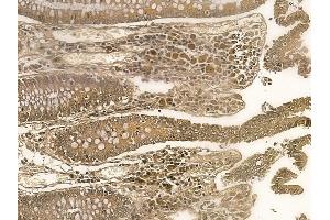 ZNF226 Mouse Monoclonal Antibody at 1/100 staining human normal colon tissue by IHC-P. (ZNF226 抗体)