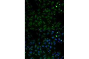 Immunofluorescence (IF) image for anti-Voltage-Dependent Anion Channel 1 (VDAC1) (AA 1-283) antibody (ABIN3021131)