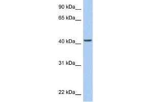 Human HeLa; WB Suggested Anti-ARID3C Antibody Titration: 0. (ARID3C 抗体  (C-Term))