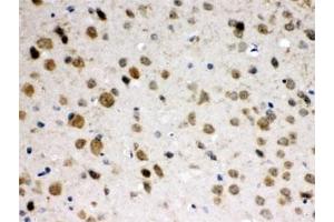 IHC testing of FFPE mouse brain with ABR antibody at 1ug/ml. (ABR 抗体)