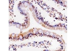 Immunohistochemistry (IHC) image for anti-Cyclin-Dependent Kinase 4 (CDK4) (AA 272-303) antibody (ABIN3030610)
