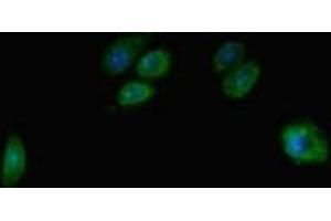 Immunofluorescent analysis of HepG2 cells using ABIN7171658 at dilution of 1:100 and Alexa Fluor 488-congugated AffiniPure Goat Anti-Rabbit IgG(H+L) (TBC1D7 抗体  (AA 1-293))