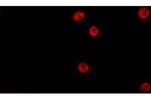 ABIN6275191 staining HepG2 by IF/ICC. (HOXA5 抗体  (Internal Region))