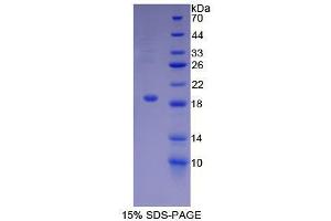 SDS-PAGE analysis of Mouse ACVR2A Protein. (ACVR2A 蛋白)