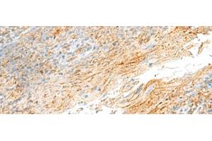 Immunohistochemistry of paraffin-embedded Human tonsil tissue using MRPS18B Polyclonal Antibody at dilution of 1:55(x200) (MRPS18B 抗体)