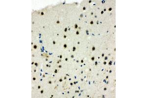 Anti-MCM6 antibody, IHC(P) IHC(P): Rat Brain Tissue (MCM6 抗体  (Middle Region))