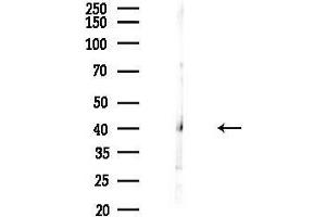anti-Pygopus Homolog 2 (PYGO2) (N-Term) antibody