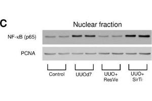 Western Blotting (WB) image for anti-Proliferating Cell Nuclear Antigen (PCNA) antibody (ABIN2854788)