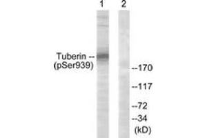 Western blot analysis of extracts from 293 cells treated with Anisomycin 25ug/ml 30', using Tuberin/TSC2 (Phospho-Ser939) Antibody. (Tuberin 抗体  (pSer939))