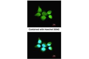 ICC/IF Image Immunofluorescence analysis of paraformaldehyde-fixed A431, using SSA1, antibody at 1:200 dilution. (TRIM21 抗体)