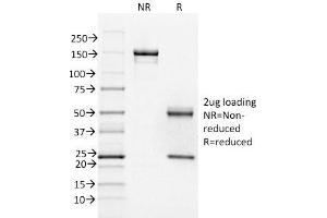 SDS-PAGE (SDS) image for anti-Forkhead Box A1 (FOXA1) (AA 372-472) antibody (ABIN6939655)