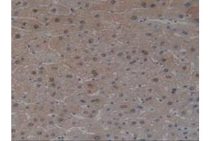 IHC-P analysis of Human Liver Tissue, with DAB staining. (Angiotensin I Converting Enzyme 1 抗体  (AA 1160-1306))