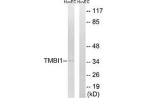 Western blot analysis of extracts from HuvEc cells, using TMBIM1 Antibody. (TMBIM1 抗体  (AA 251-300))